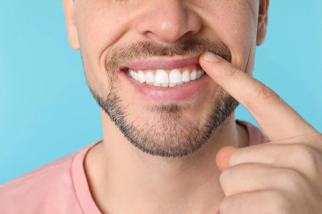 Gingiwektomia – na czym polega chirurgiczna korekta dziąseł_Easy-Resize.com.jpg