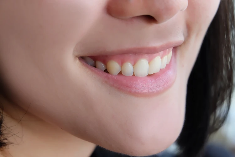 Uśmiechnięta kobieta: zbliżenie na zęby