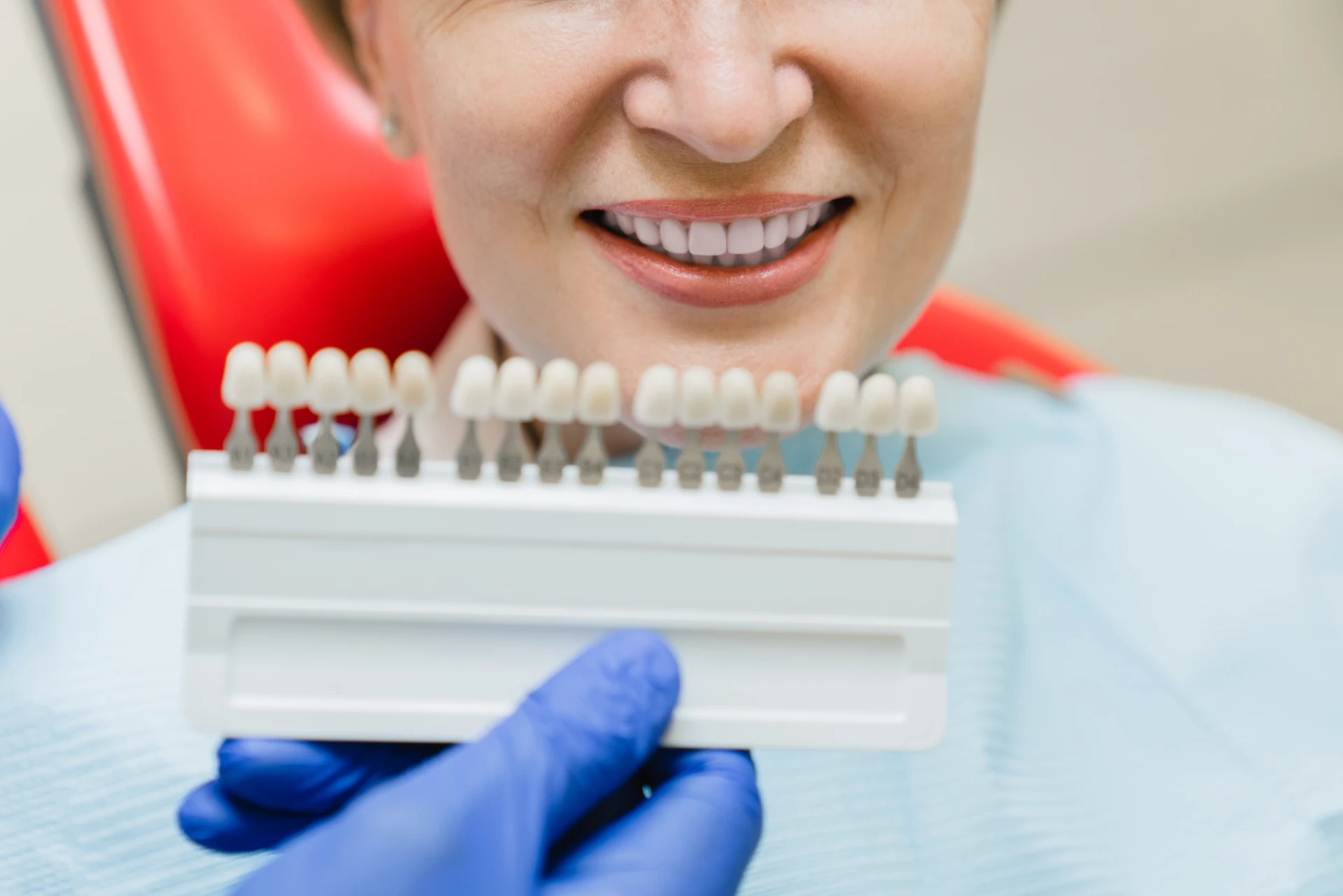 Konsultacja z dentystą w sprawie odcienia licówek na zęby