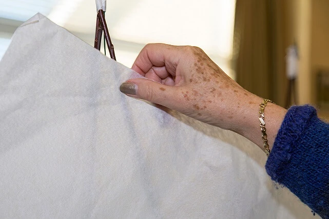 Co oznaczają plamy wątrobowe? Kiedy udać się do lekarza?