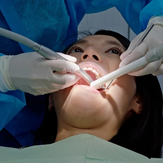 ekstrakcja zęba u stomatologa