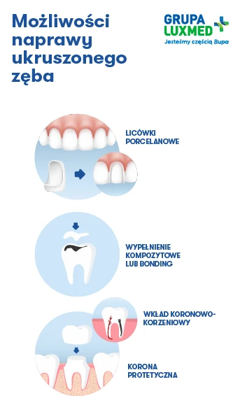 infografika-możliwości-naprawy-ukruszonego-zęba