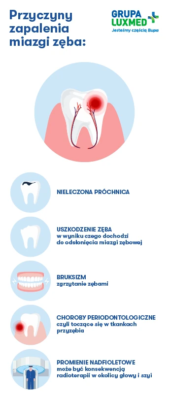 przyczyny zapalenia miazgi zęba - infografika