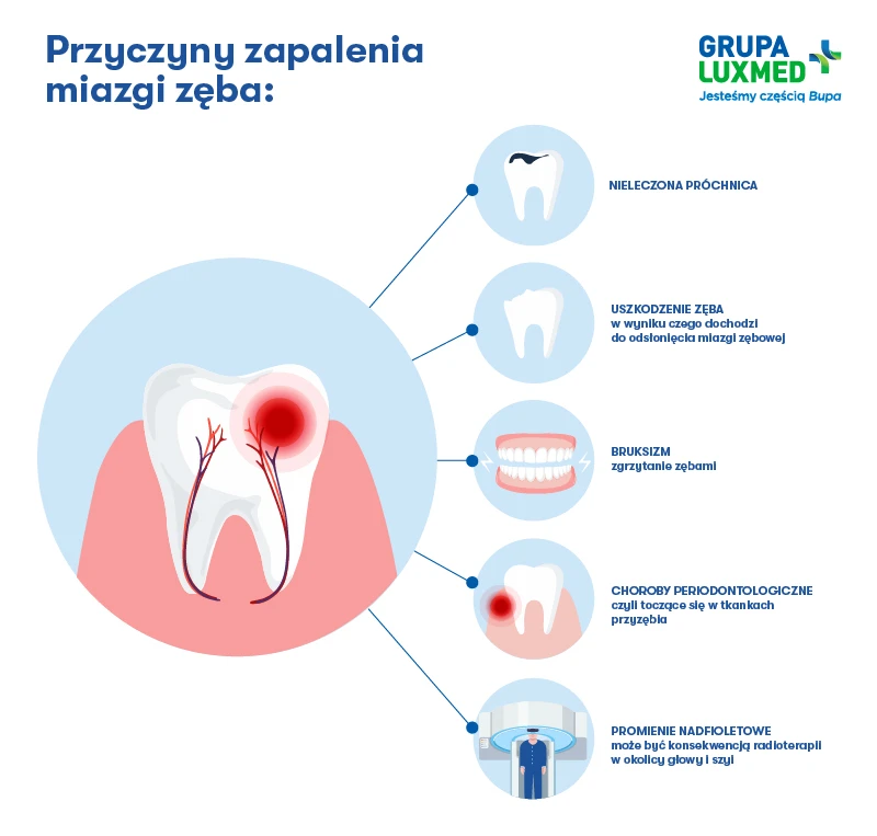 przyczyny zapalenia miazgi zęba - infografika