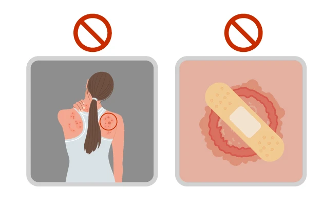 zdjecie-zmiany-skornej-krok-6.jpg
