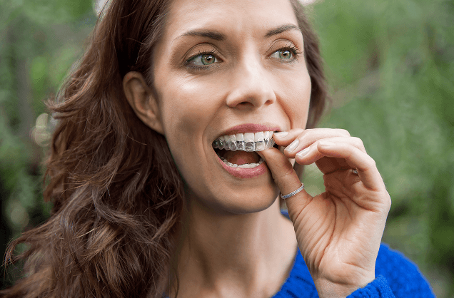 Pacjentka z nakładkami Invisalign