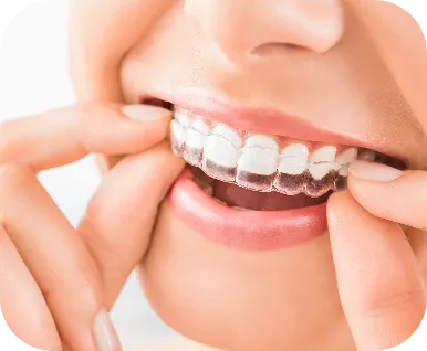 Nakładki ortodontyczne