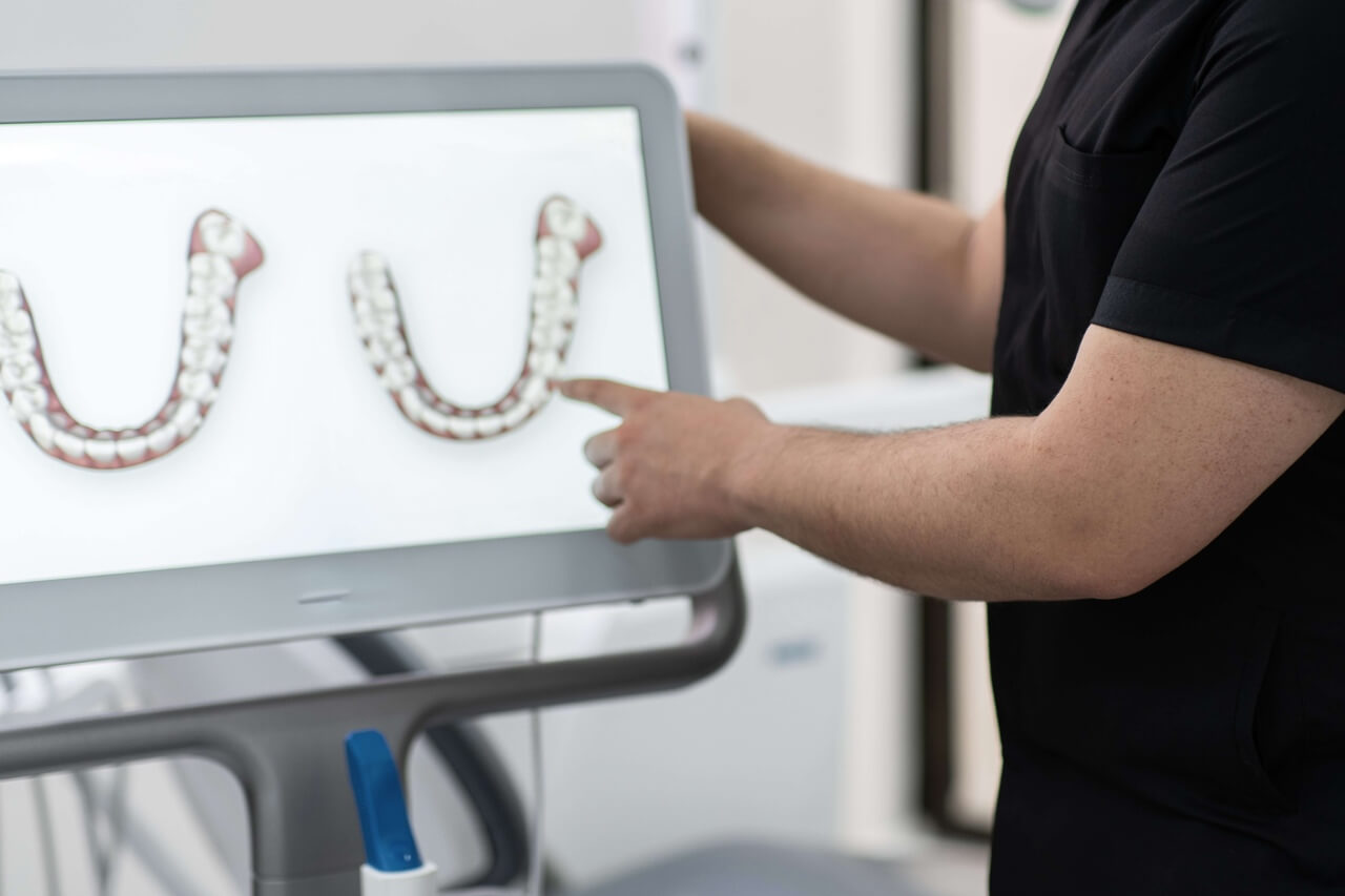 Lekarz objaśnia etapy leczenia aparatem Invisalign