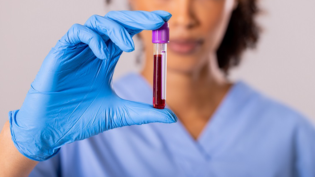 Pakiet badań laboratoryjnych na anemię - Kontrola anemii